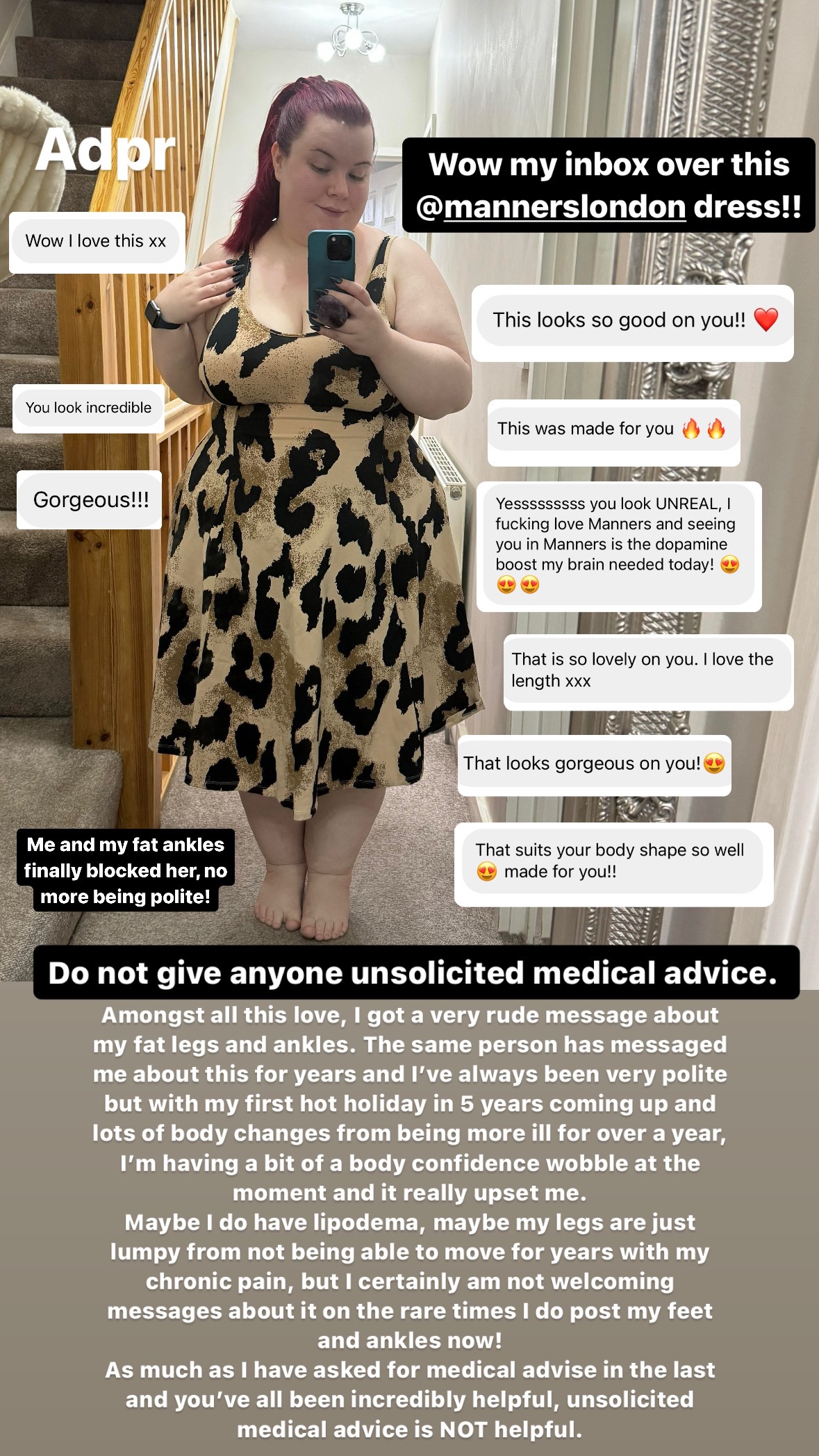 Getting Diagnosed with Lipoedema 4 Getting Diagnosed with Lipoedema 3