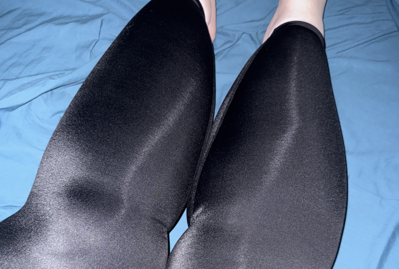 Getting Diagnosed with Lipoedema 3 Getting Diagnosed with Lipoedema 2